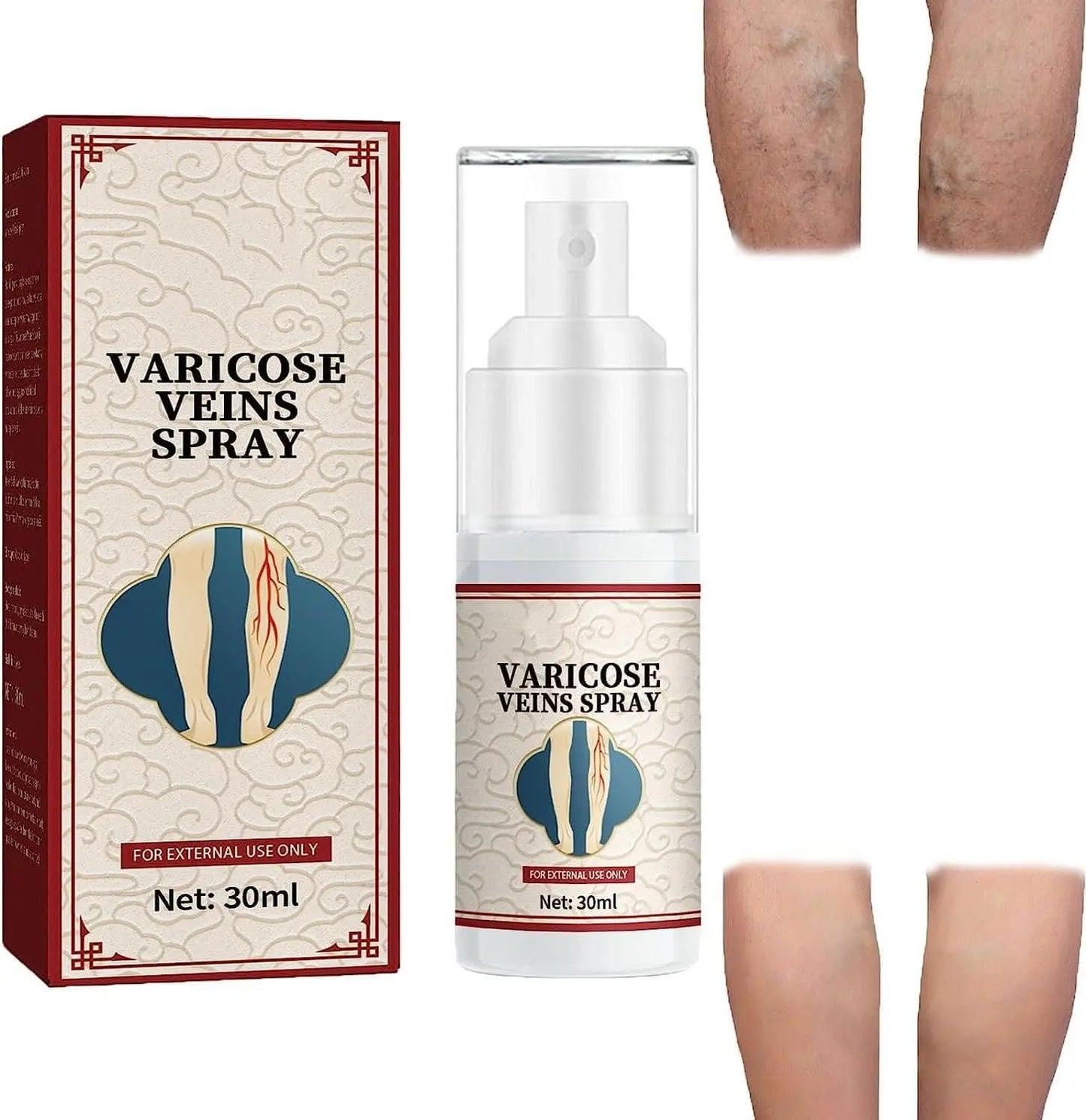 Vein Healing Varicose Veins Treatment Spray ( Pack of 2 )